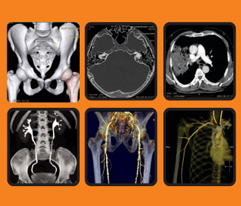 CT Scans Images
